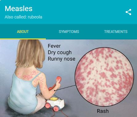 Measles